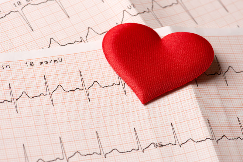 ekg ritm cardiac
