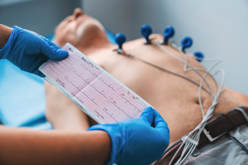 pacient caruia i se face o EKG